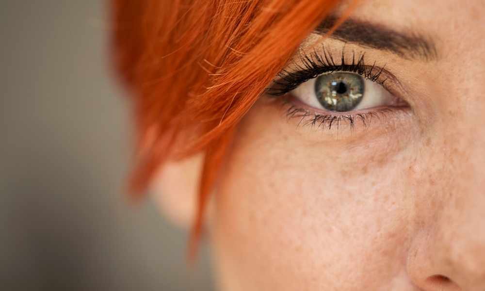 Badem Göz Estetiği Ameliyatı